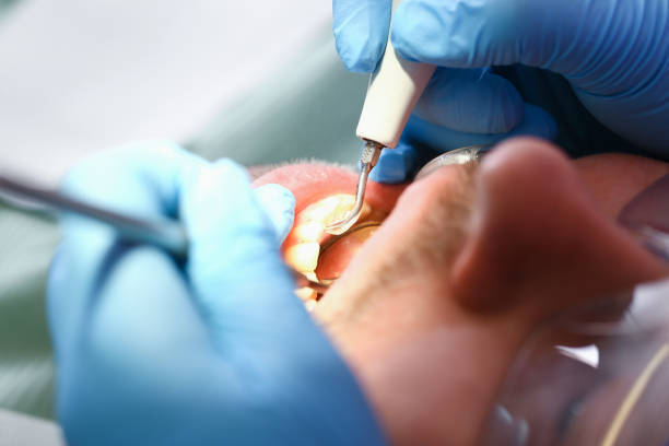 Best Pediatric Emergency Dentist in Hooks, TX