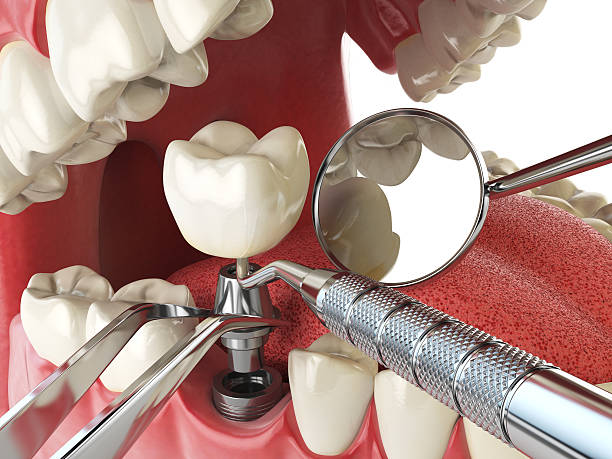 Best Broken or Cracked Tooth Emergency Dentist in Hooks, TX